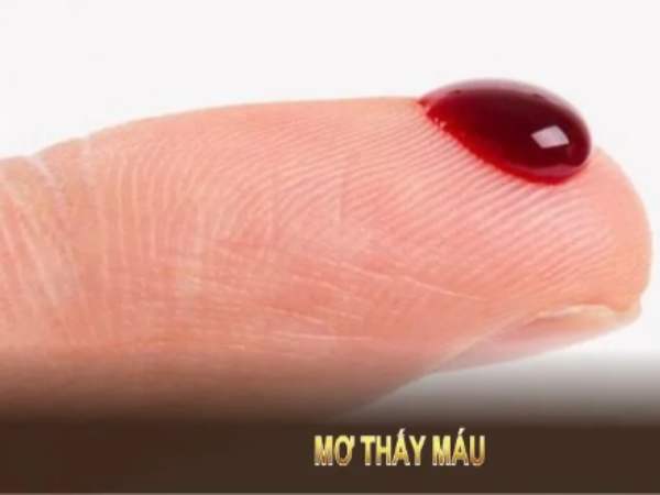 Mơ thấy máu của ai đó chảy ý nghĩa gì? Mơ thấy máu của ai đó chảy ý nghĩa gì?